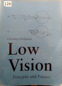 Image of Low vision : principles and practice